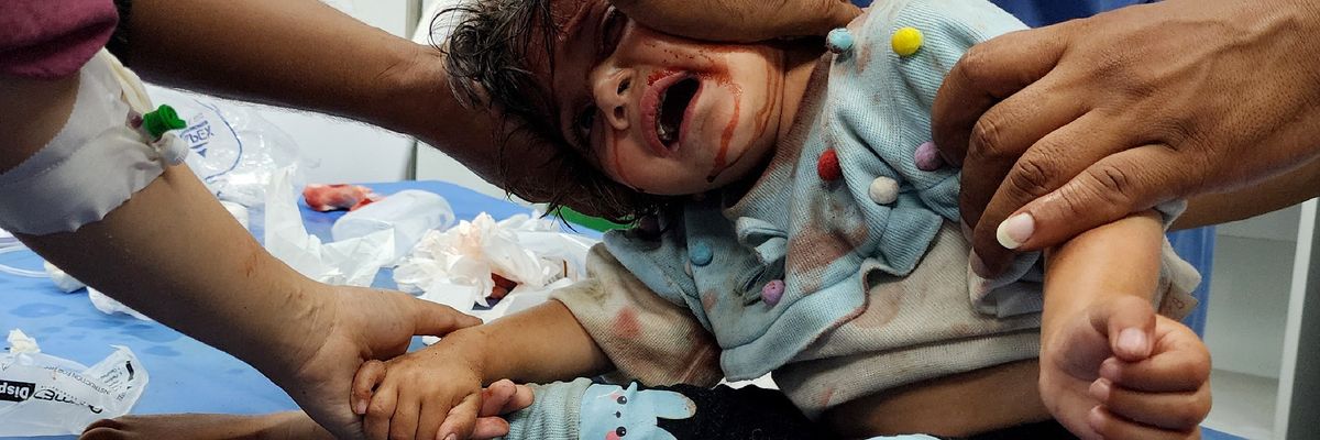 A wounded child is brought to UAE Hospital in Rafah after Israel bombed tents full of displaced Gazans, killing at least 45 and severely wounding hundreds 