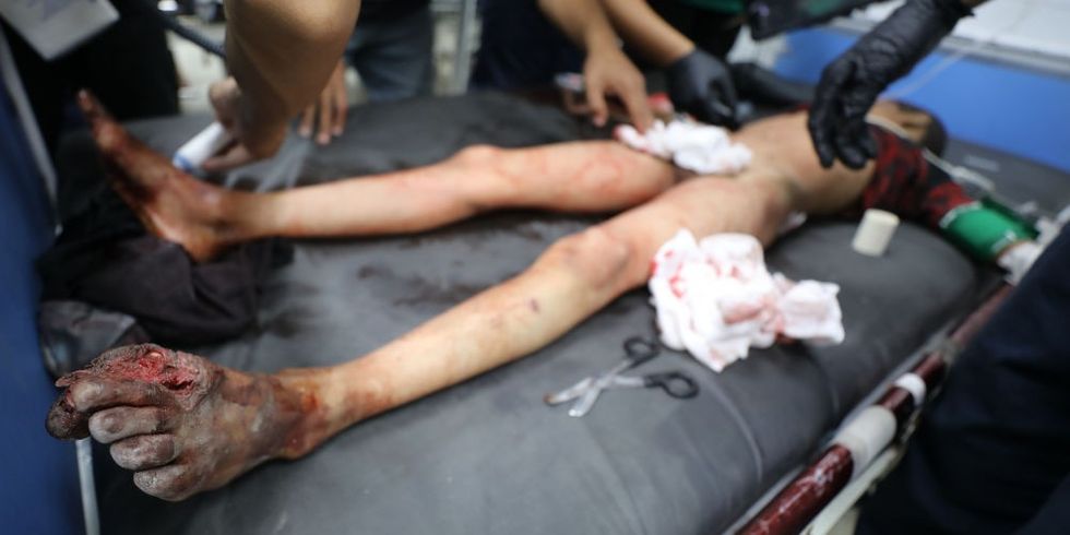 Boy injured in Israeli attack on Jabalia Refugee Camp is treated at al-Ahli Baptist Hospital 