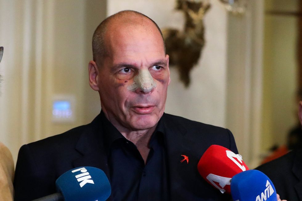 After Brutal Assault, Yanis Varoufakis Urges Progressives to Focus on 'What Really Matters'